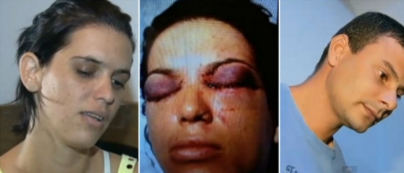Ex-marido de Mara Rbia a atacou em casa e disse que ia mat-la. A vtima perdeu a viso de um dos olhos