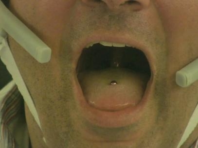O piercing do tamanho de um feijão produz um campo magnético que muda quando a língua se movimenta