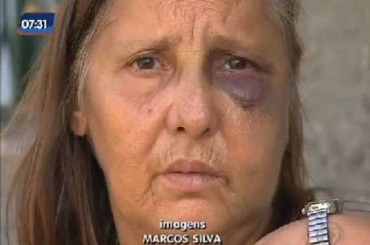 Diva Santos ficou com hematomas aps ter sofrido agresses 